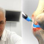 Ορθοπεδικός Ανέστης Γεωργιάδης: Φως στο «Λιπαντικό» των αρθρώσεων – Όλα όσα πρέπει να ξέρουμε για το Υαλουρονικό Οξύ