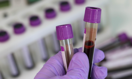 Παγκόσμια πρωτιά: Κυτταρική θεραπεία «επαναπρογραμμάτισε» το ανοσοποιητικό σύστημα μιας γυναίκας με τρία αυτοάνοσα νοσήματα